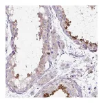 Atlas Antibodies Anti-TBC1D3L Antibody