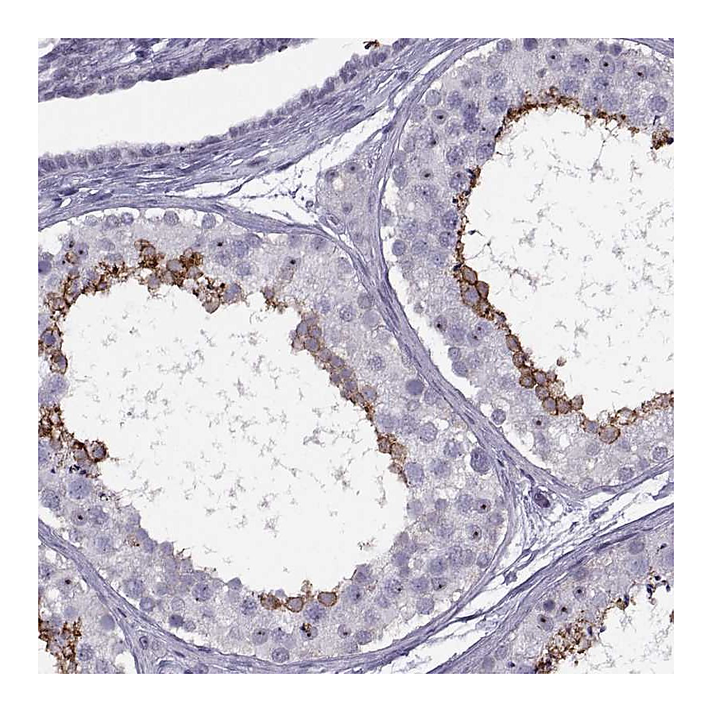 Atlas Antibodies Anti-TBC1D3C Antibody