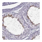 Atlas Antibodies Anti-TBC1D3C Antibody