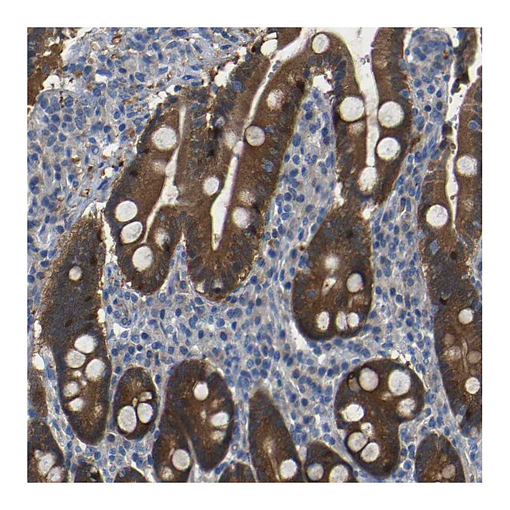 Atlas Antibodies Anti-TBC1D32 Antibody