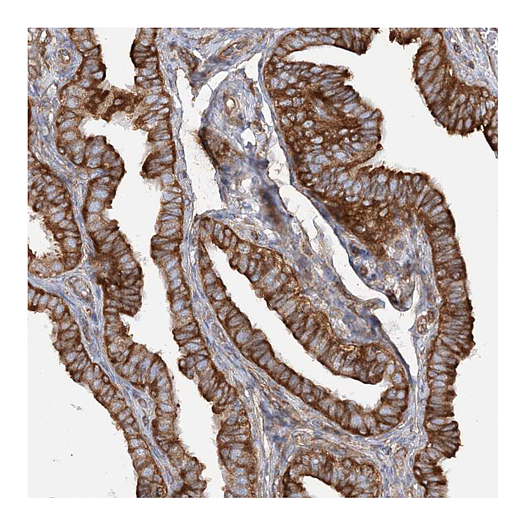 Atlas Antibodies Anti-TBC1D5 Antibody