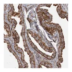 Atlas Antibodies Anti-TBC1D5 Antibody