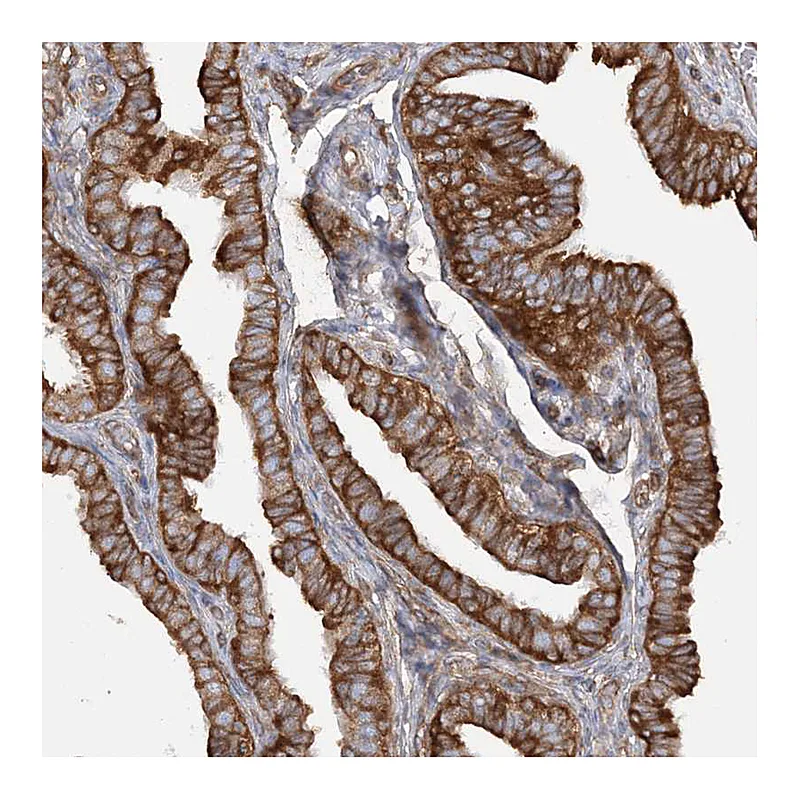 Atlas Antibodies Anti-TBC1D5 Antibody