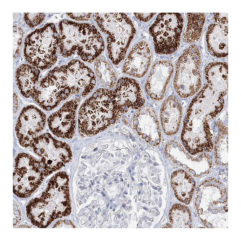 Atlas Antibodies Anti-TBC1D7 Antibody