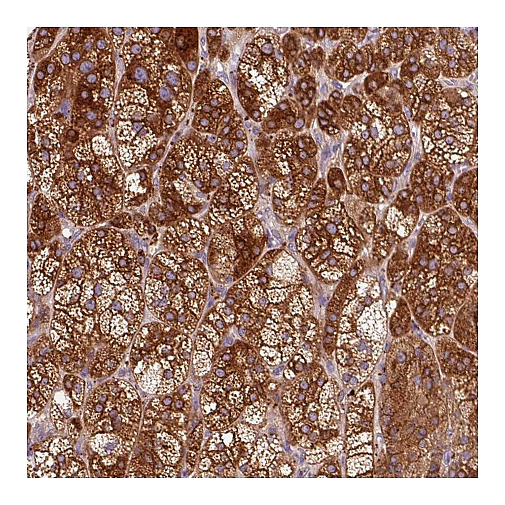 Atlas Antibodies Anti-TBC1D4 Antibody