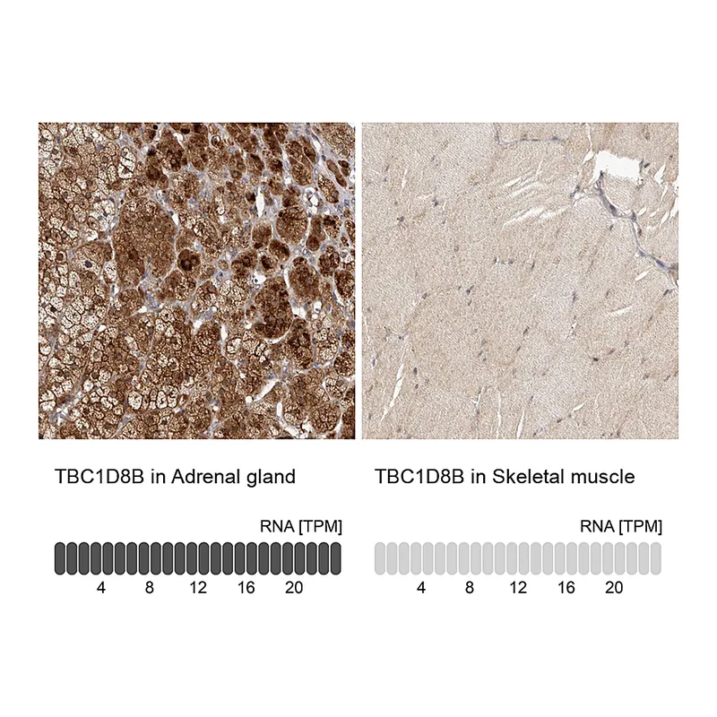 Atlas Antibodies Anti-TBC1D8B Antibody