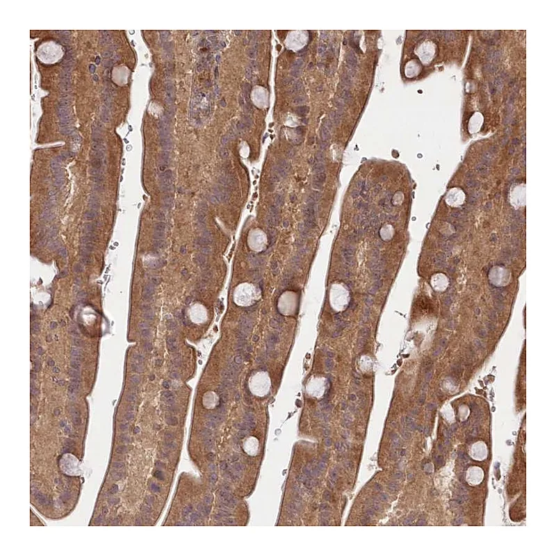 Atlas Antibodies Anti-TBCA Antibody