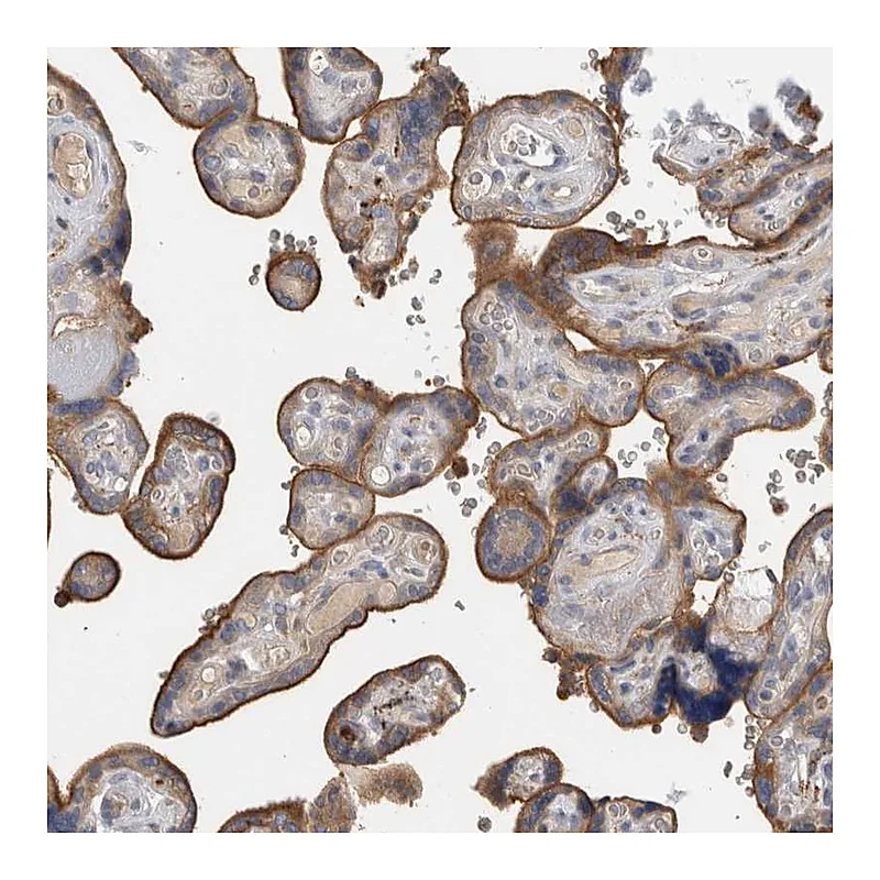 Atlas Antibodies Anti-TBCE Antibody
