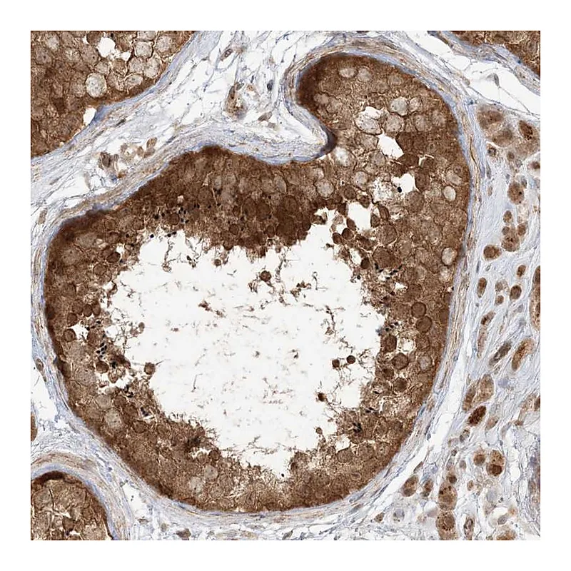Atlas Antibodies Anti-TBCC Antibody