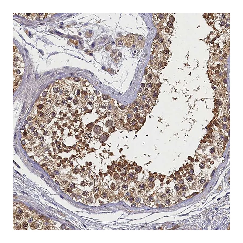 Atlas Antibodies Anti-TBCB Antibody