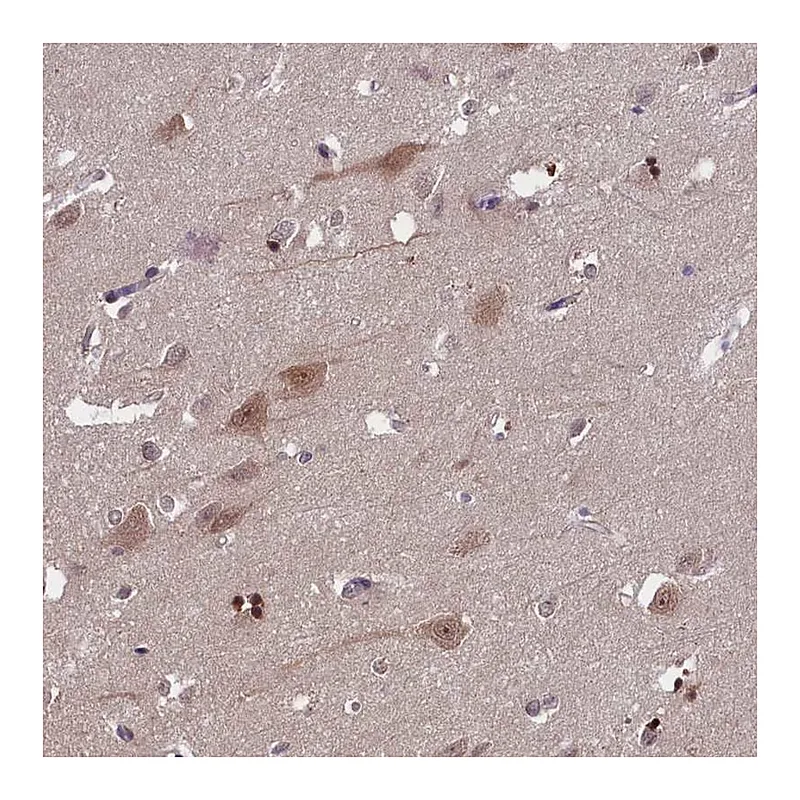 Atlas Antibodies Anti-TBCB Antibody