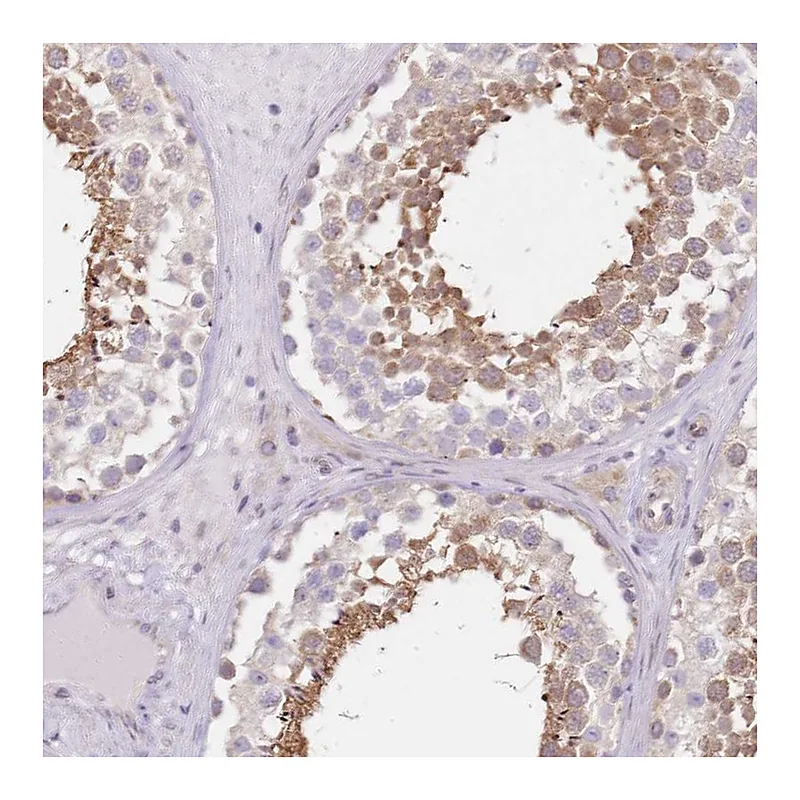 Atlas Antibodies Anti-TBC1D9 Antibody
