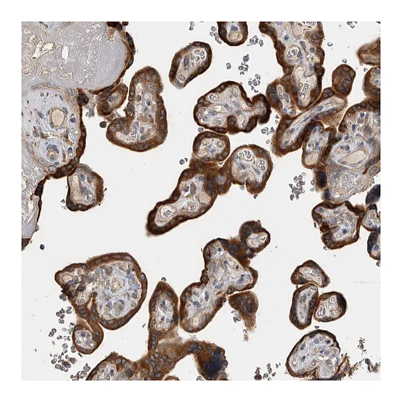 Atlas Antibodies Anti-TBCE Antibody