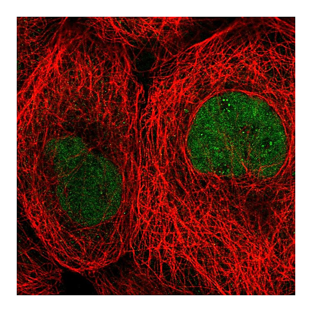 Atlas Antibodies Anti-TBCK Antibody