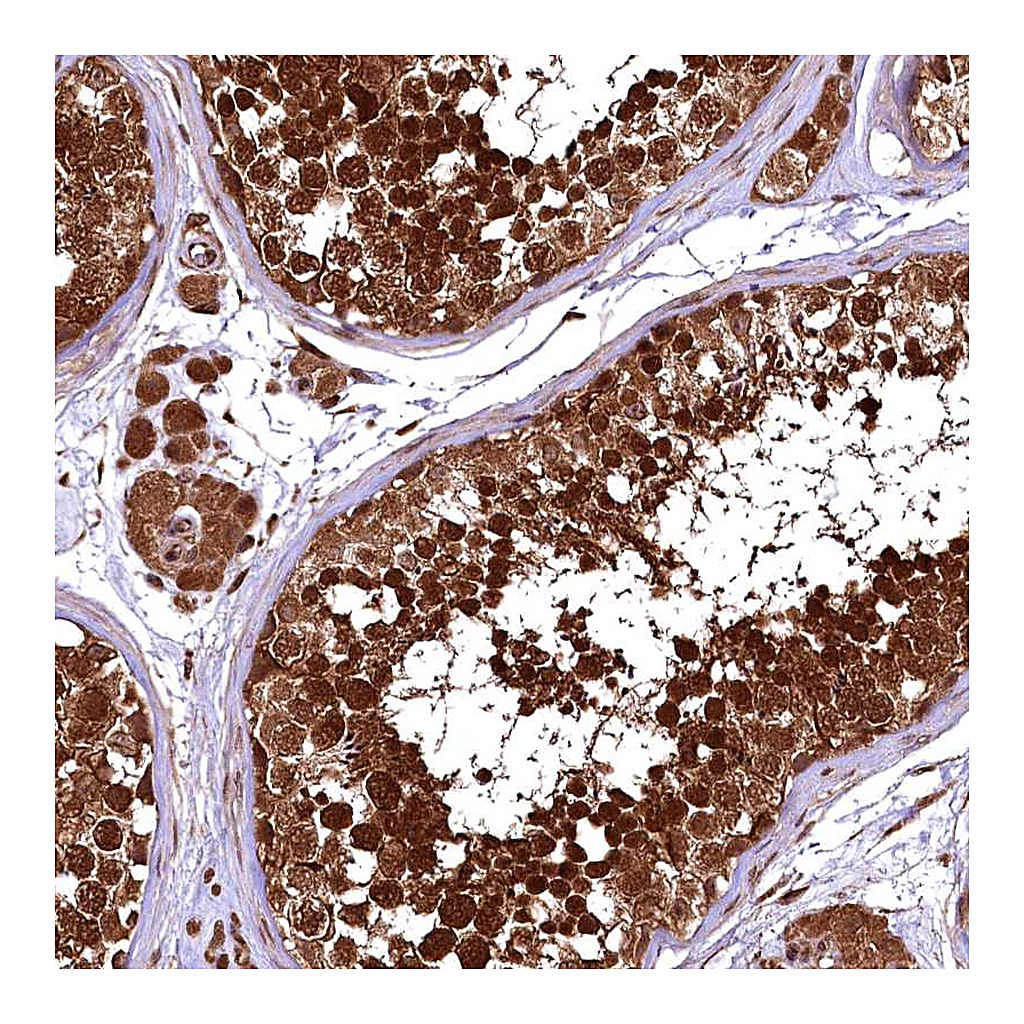 Atlas Antibodies Anti-TBCEL Antibody