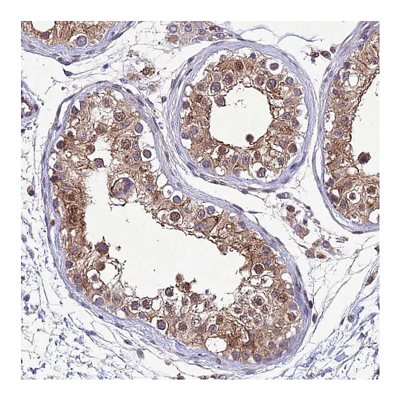 Atlas Antibodies Anti-TBK1 Antibody
