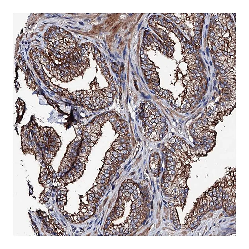 Atlas Antibodies Anti-TBCEL Antibody