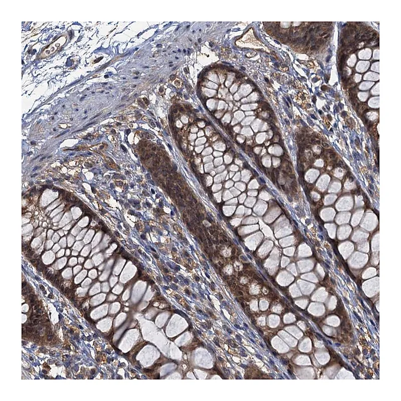 Atlas Antibodies Anti-TBCK Antibody