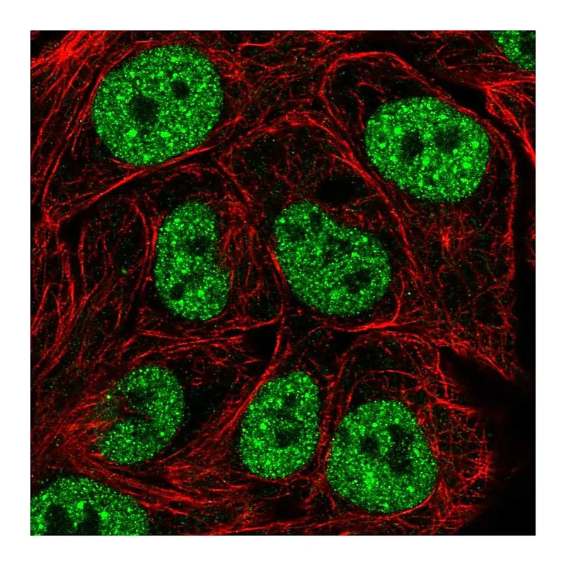 Atlas Antibodies Anti-TBK1 Antibody