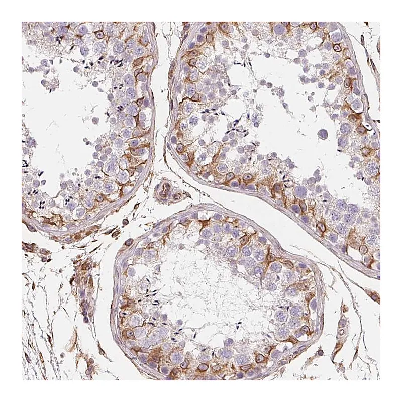 Atlas Antibodies Anti-TBKBP1 Antibody