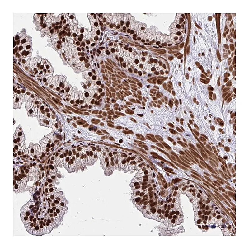 Atlas Antibodies Anti-TBL1Y Antibody