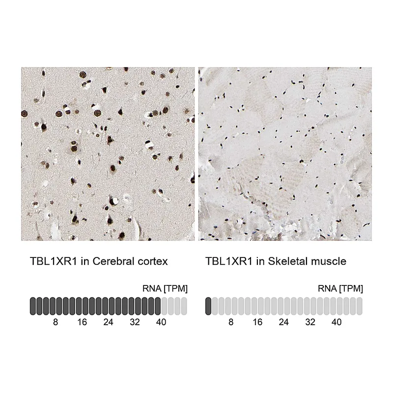 Atlas Antibodies Anti-TBL1XR1 Antibody