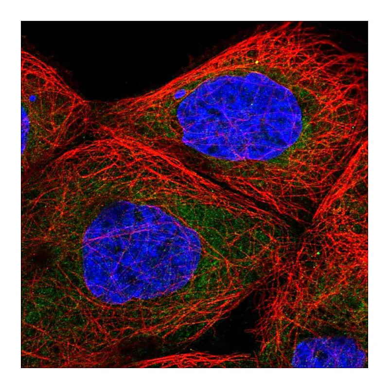 Atlas Antibodies Anti-TBL2 Antibody