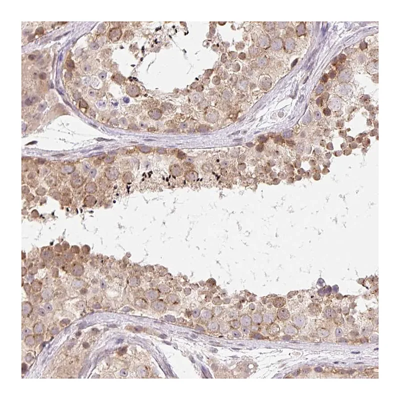Atlas Antibodies Anti-TBPL2 Antibody
