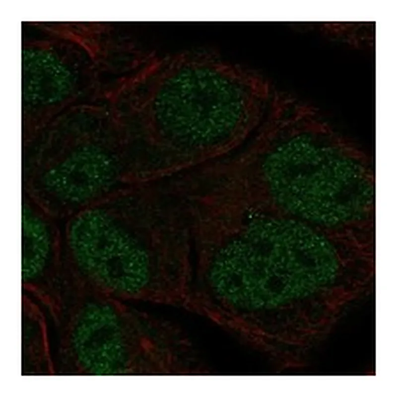 Atlas Antibodies Anti-TBL1Y Antibody