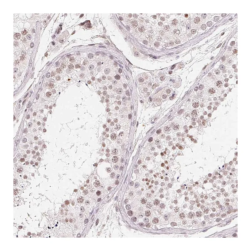 Atlas Antibodies Anti-TBP Antibody