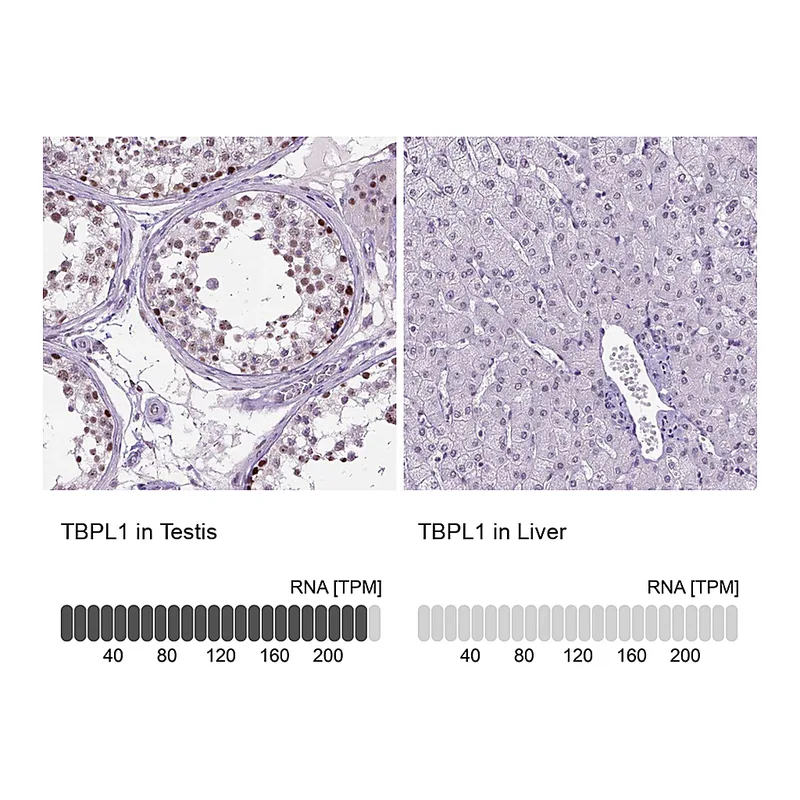 Atlas Antibodies Anti-TBPL1 Antibody