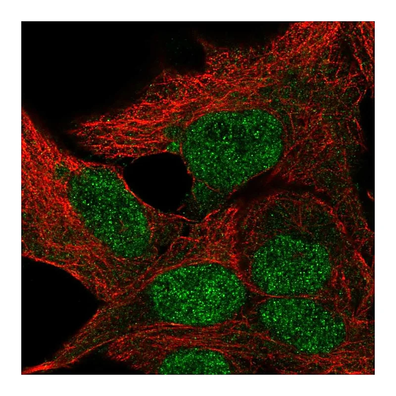 Atlas Antibodies Anti-TBPL1 Antibody