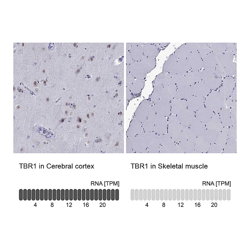 Atlas Antibodies Anti-TBR1 Antibody