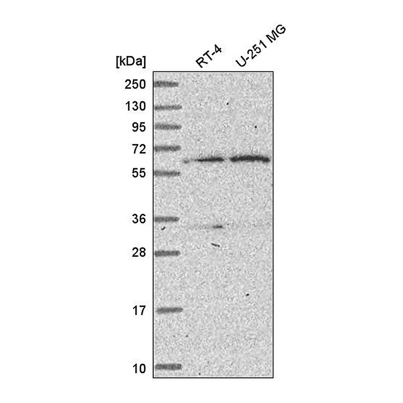 Atlas Antibodies Anti-TBRG4 Antibody