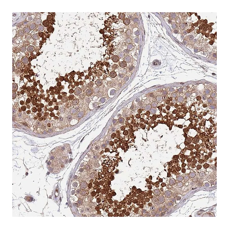 Atlas Antibodies Anti-TBX10 Antibody