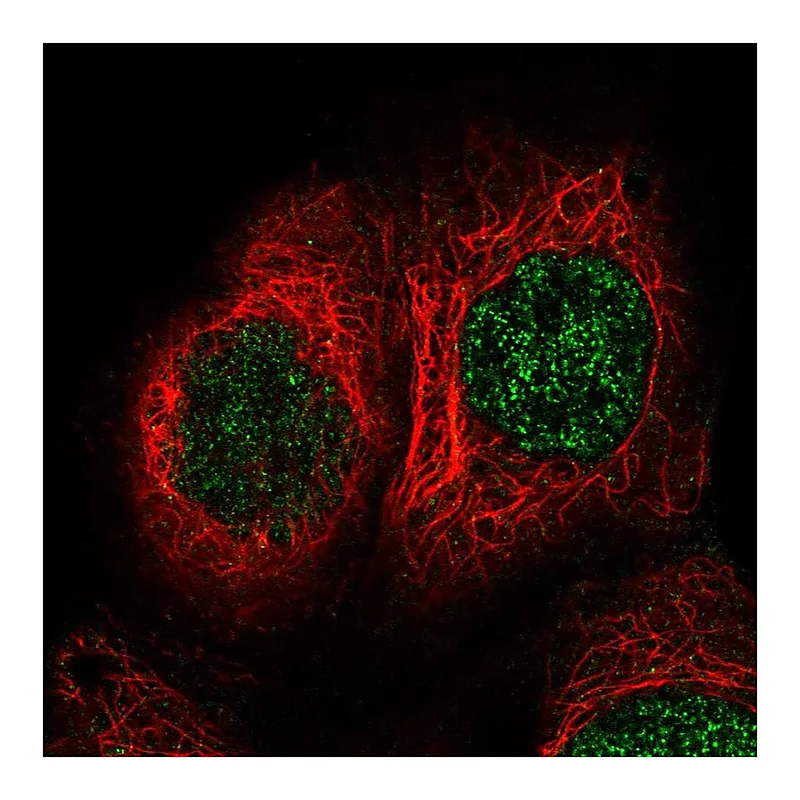 Atlas Antibodies Anti-TBRG1 Antibody