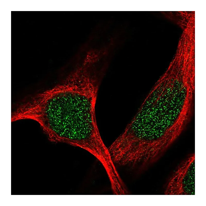 Atlas Antibodies Anti-TBRG1 Antibody