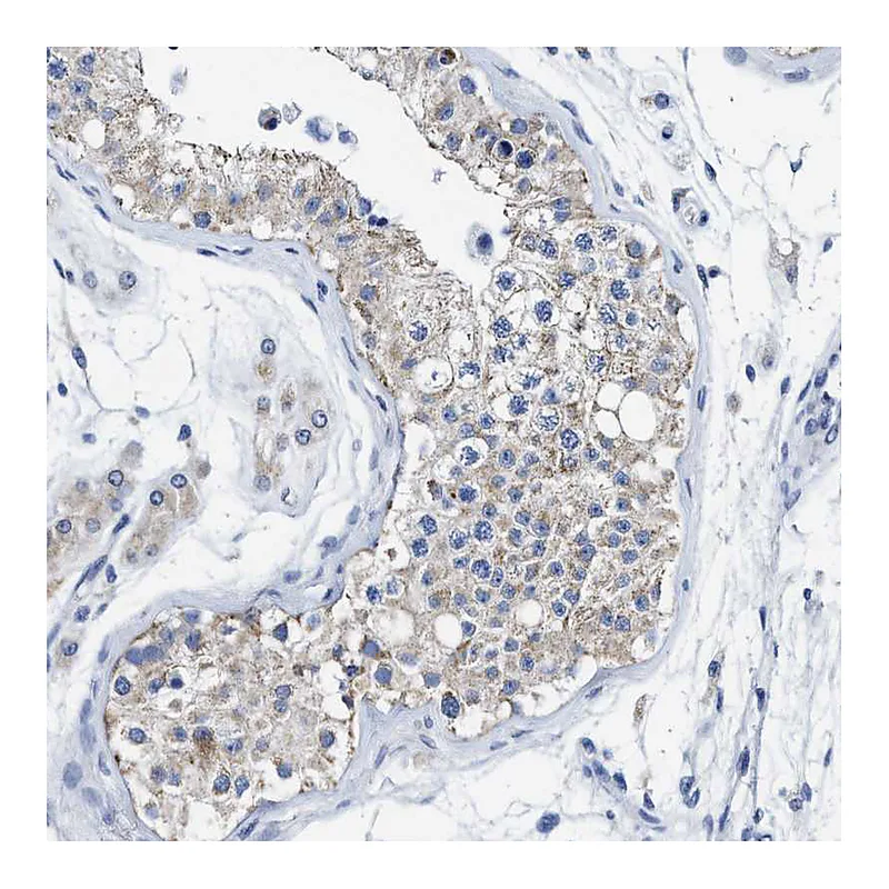 Atlas Antibodies Anti-TBRG4 Antibody