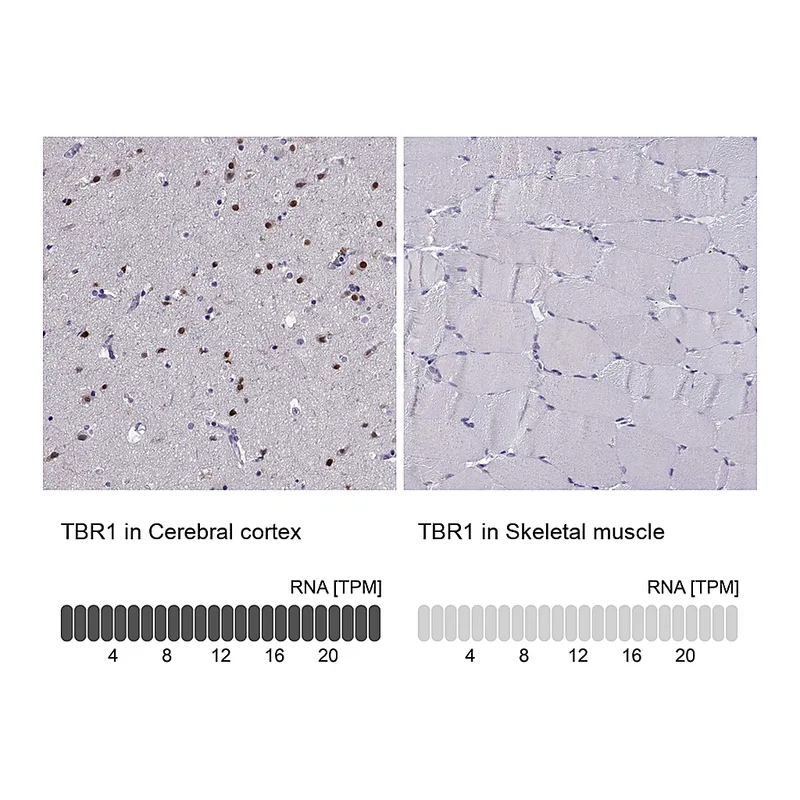 Atlas Antibodies Anti-TBR1 Antibody