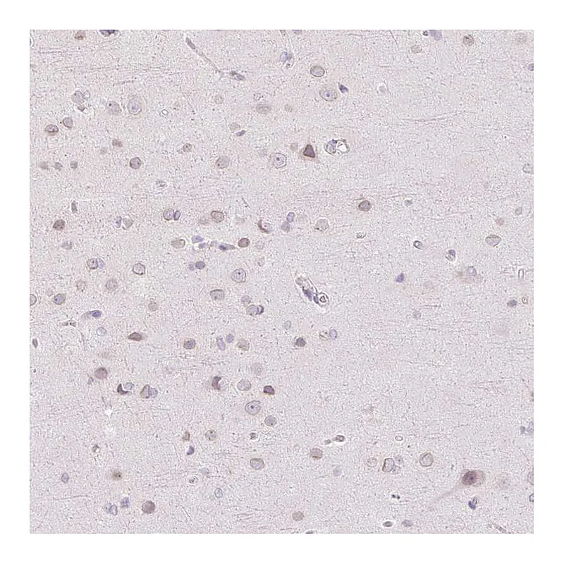 Atlas Antibodies Anti-TBX15 Antibody