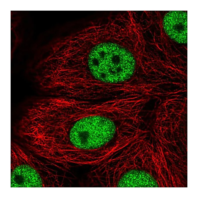 Atlas Antibodies Anti-TBX2 Antibody