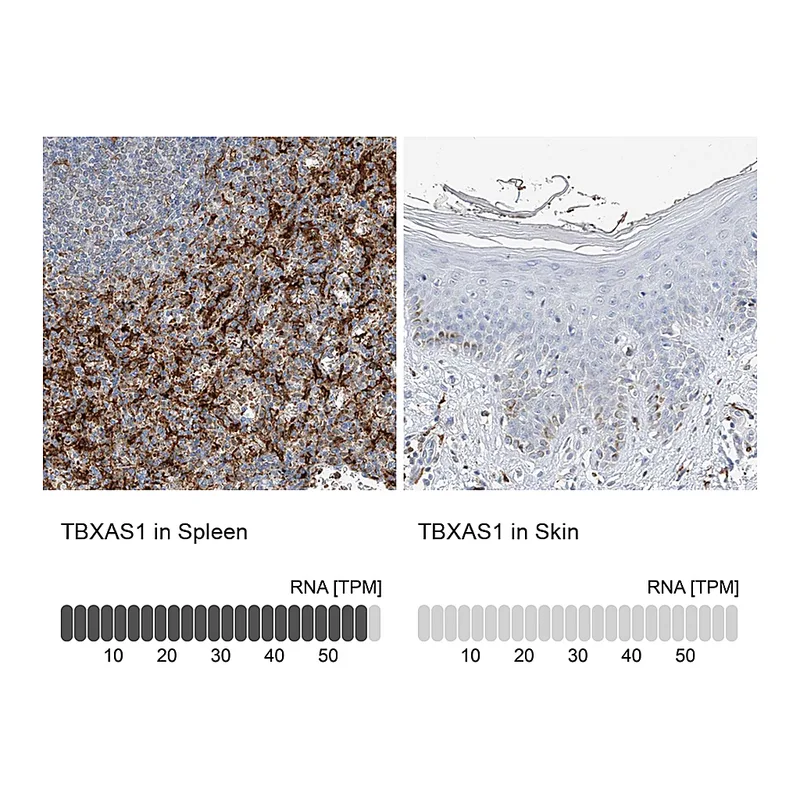 Atlas Antibodies Anti-TBXAS1 Antibody