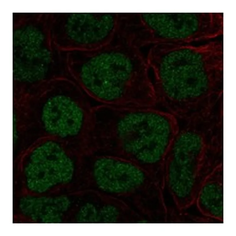 Atlas Antibodies Anti-TBX3 Antibody