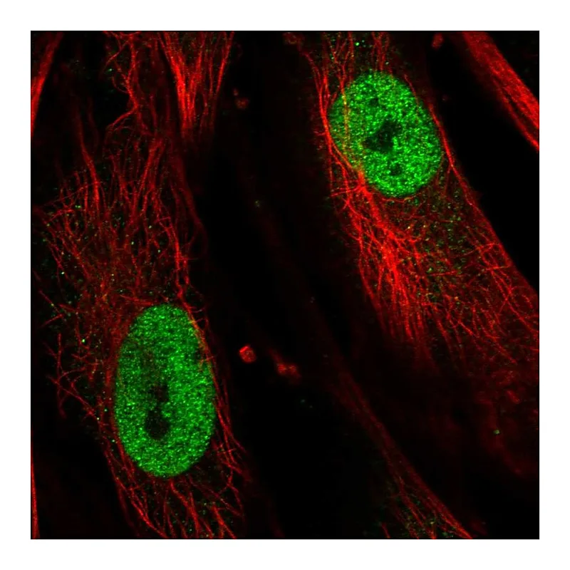 Atlas Antibodies Anti-TBX5 Antibody