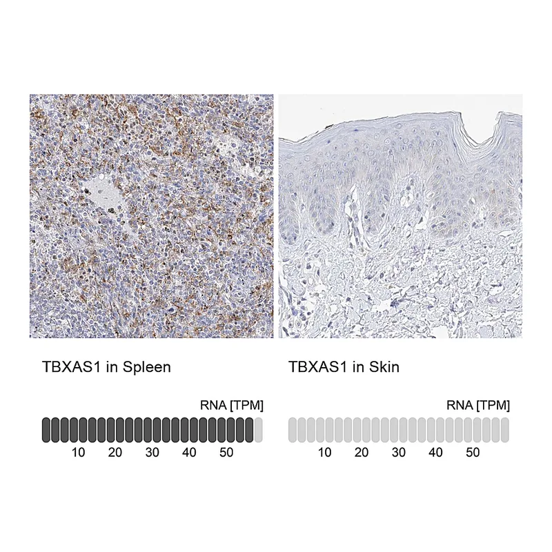 Atlas Antibodies Anti-TBXAS1 Antibody