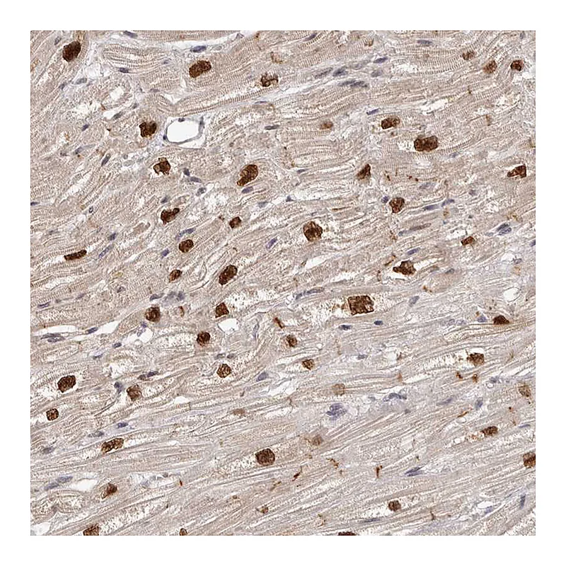 Atlas Antibodies Anti-TBX5 Antibody