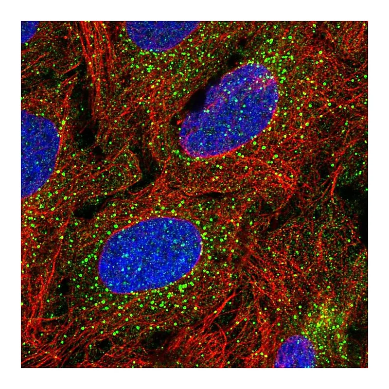 Atlas Antibodies Anti-TBX4 Antibody