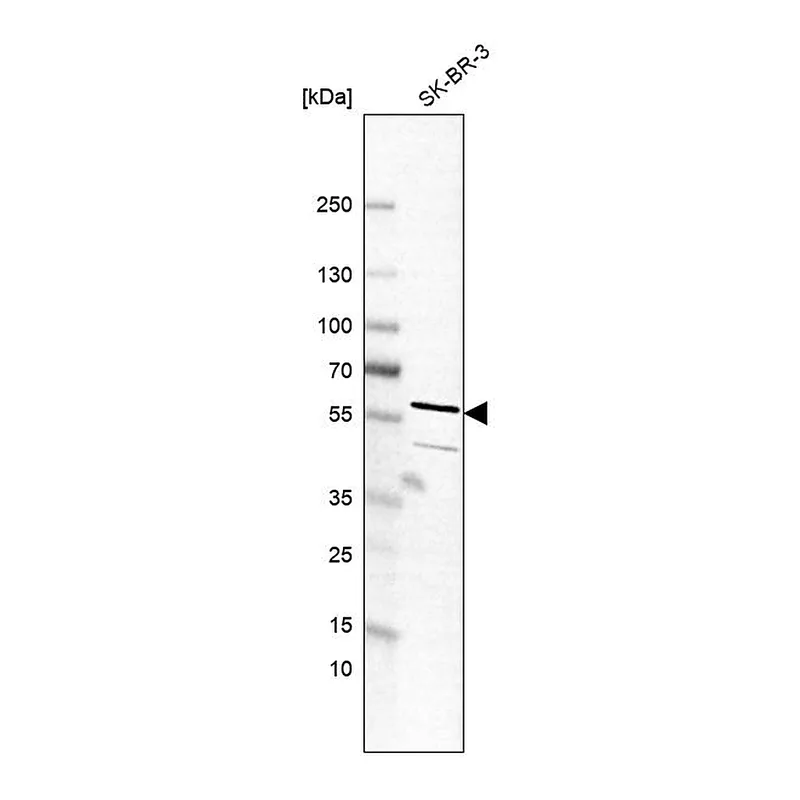 Atlas Antibodies Anti-TC2N Antibody