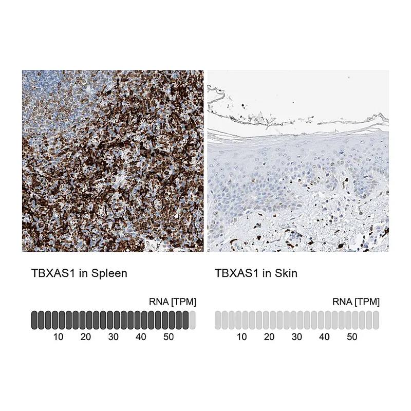 Atlas Antibodies Anti-TBXAS1 Antibody