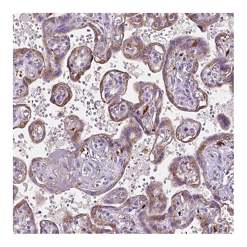 Atlas Antibodies Anti-TCAF1 Antibody